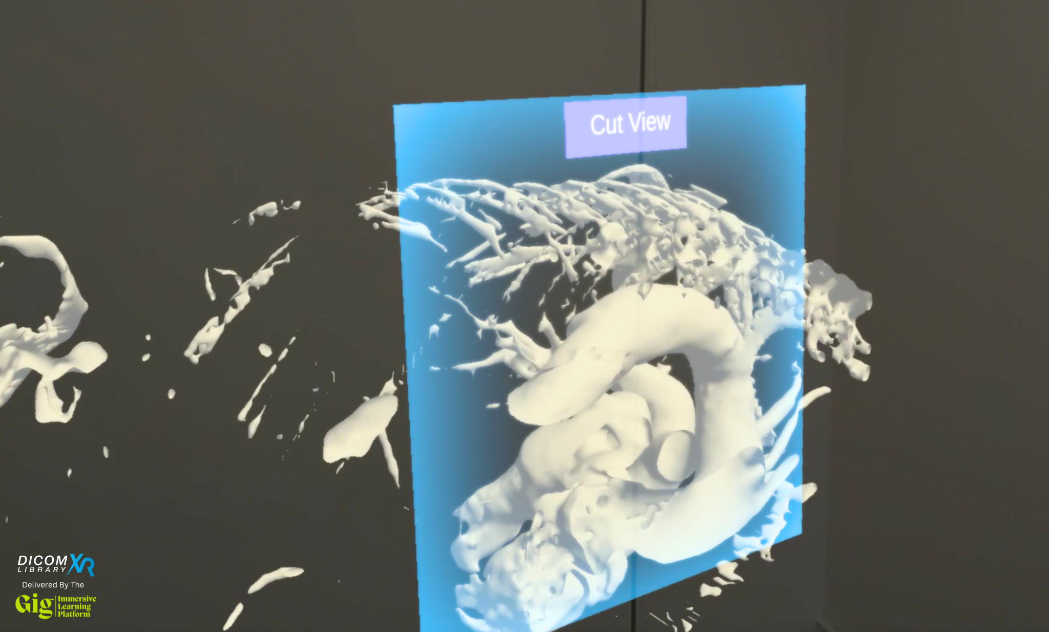 An example image from the new GigXR DICOM library of MRI and CT scans